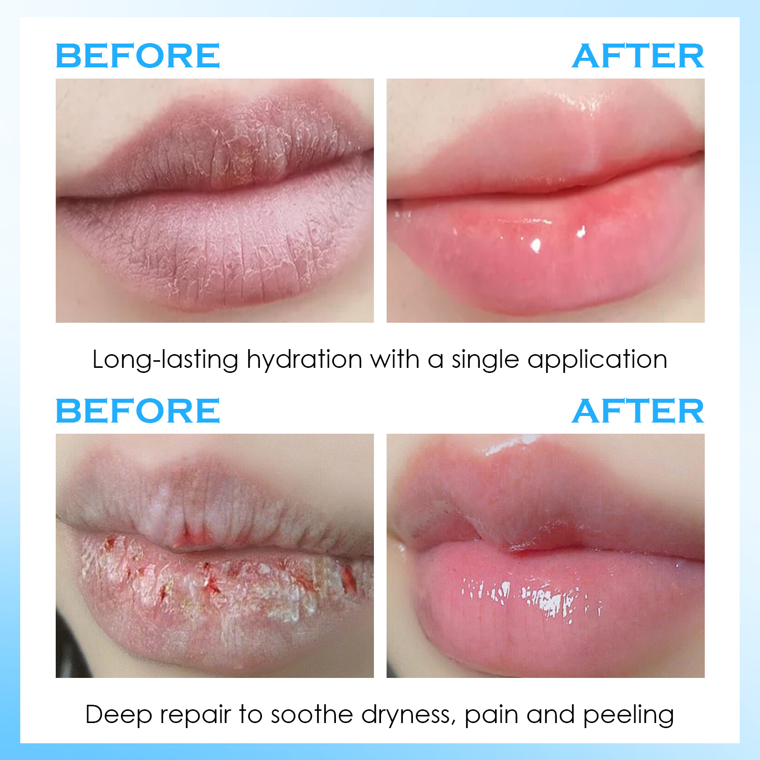 Lip Serum Moisturizing Balm Hy - Lip Balm review and price